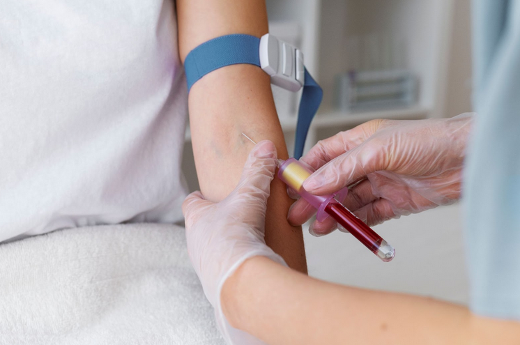 كيفية إجراء تحليل الفيتامينات الشامل؟